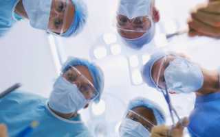 Флегмонозный аппендицит — тяжёлая патология для экстренной хирургии