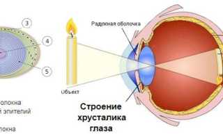 Реабилитация после операции по замене хрусталика глаза при катаракте