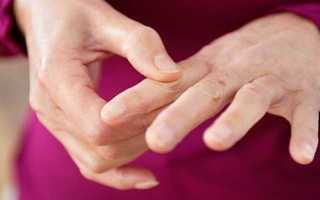 Симптомы, лечение и диагностика Недифференцированного артрита