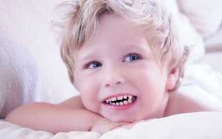 Бруксизм, или ночной скрежет зубами у детей