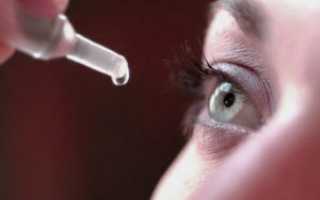 Блефароконъюнктивит глаз: что это такое и как лечить