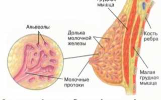 Кисты молочных желез (груди): виды, причины, симптомы и лечение