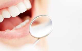 Как выбрать лучшие зубные пломбы: советы стоматолога