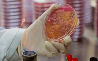 Бактериурия: безобидное явление или грозный симптом?