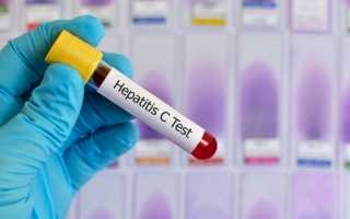 Первые признаки гепатита «С», по которым можно узнать заболевание