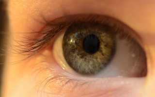 Аллергия на глазах у ребенка: причины, лечение, капли