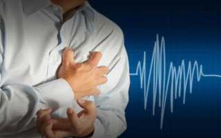 Болит сердце — как отличить ВСД от сердечного приступа