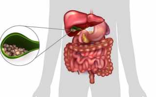 Дискинезия желчевыводящих путей (ДЖВП): как узнать и лечить заболевание