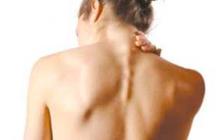 Боли в мышцах при ВСД, как справиться с симптомом?