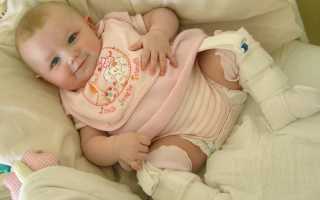 Почему хрустят суставы у младенцев и о чем это может говорить