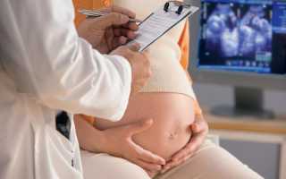 Недержание мочи при беременности: как справиться с недугом