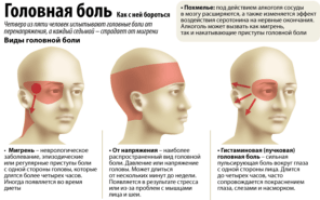 Цефалгический синдром и вегетососудистая дистония: симптомы, лечение