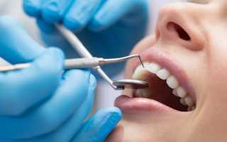 Особенности лечения зубных заболеваний.