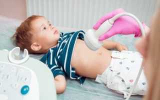 Низкое давление у ребенка: причины, симптомы и лечение гипотонии у детей и подростков
