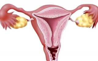 Миома матки: частая болезнь женской репродуктивной системы