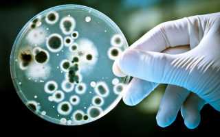 Бессимптомная бактериурия: в каких случаях требуется лечение