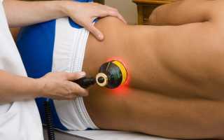 Эффективность лазерной терапии при лечении остеохондроза
