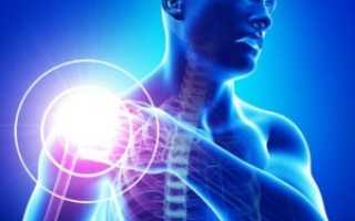 Основные симптомы и методы лечения полиартрита плечевого сустава