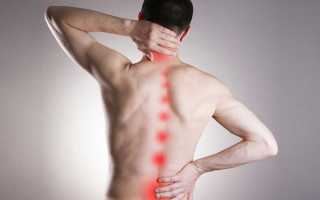 Причины и симптомы остеохондроза с корешковым синдромом