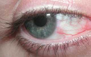 Перенапряжение глаз: симптомы и глазные капли от напряжения и усталости