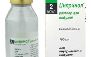 Лечение неосложненной инфекции мочевыводящих путей у женщин препаратом Ципринол