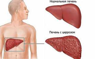 Симптомы и признаки гепатита «С» у мужчин