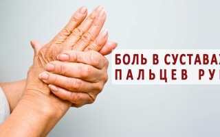 Как победить полиартрит на пальцах рук