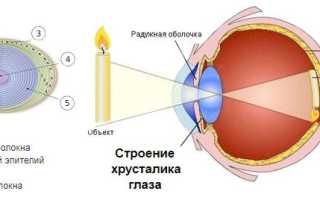 Причины возникновения катаракты глаз у взрослых и детей